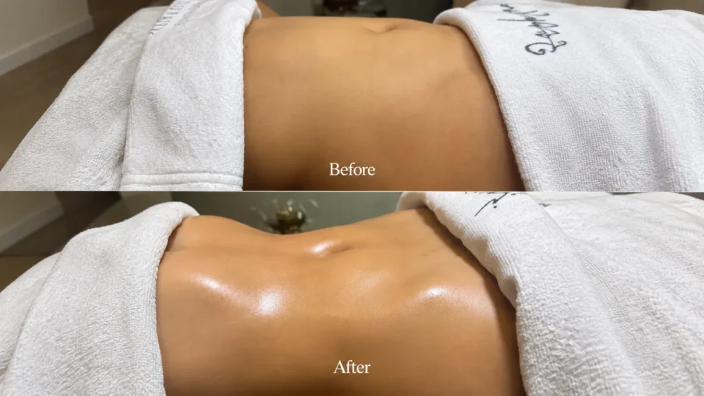 Lymphatic Drainage Massage Before And After 6 Stomach Lymphatic Massage Before And After