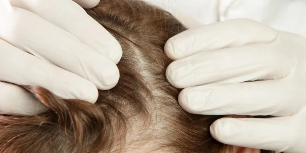 Scalp Detox: How Professional Treatments Remove Build-Up 1 Scalp Detox Checking
