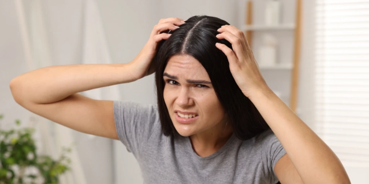Oily Scalp Vs. Dry Scalp: Why Diy Fails &Amp; How A Head Spa Fixes It 1 A Frustrated Woman Examining An Itchy, Flaky Scalp With Dandruff In A Bright Indoor Setting, Highlighting The Need For Scalp Health And Treatment
