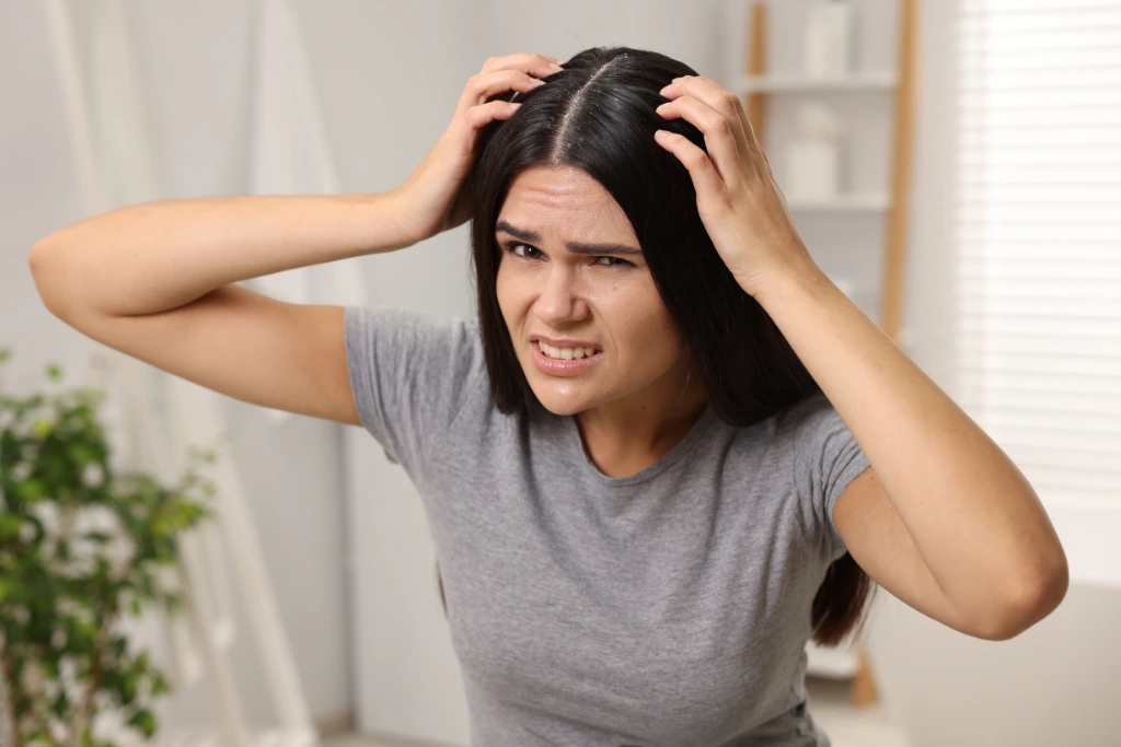 A frustrated woman examining an itchy, flaky scalp with dandruff in a bright indoor setting, highlighting the need for scalp health and treatment.