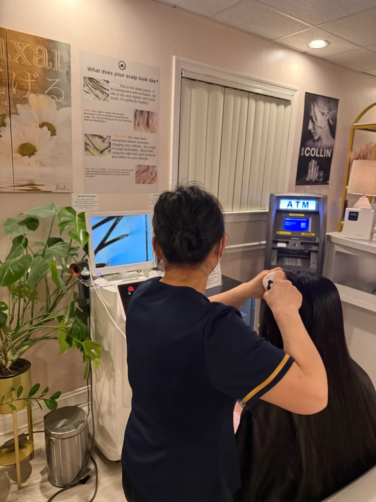 Scalp Condition Analysis